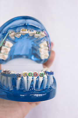 포토 JPG 해외이미지 모델 학생 건강 치과 사람없음 치료 금속 공구 도자기 투명 클래식 닫기 치아 치과의사 거짓 돌봄 해외포토 컨셉 의학 모션 재질 병원 의사 도구 소화기관 파일형식 이미지허브