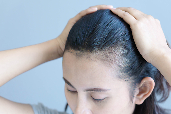 포토 JPG 해외이미지 여자 실내 한명 상반신 성인 뷰티 머리카락 흰배경 두피케어 탈모 탈모클리닉 성인여자한명만 탈모예방 숱 해외포토 1 백그라운드 사람 내부 머리 흰색 예방 클리닉 헤어관리 증상 여자한명만 성인여자만 파일형식 이미지허브