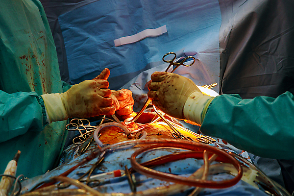 포토 JPG 해외이미지 직업 손 장갑 건강 병원 사람 사람없음 치료 약 건강관리 모니터 방 장비 환자 의사 하트 심장 긴급 수술 질병 외과 테라피 순서 해외포토 모양 잡화 의학 관리 신체부위 컴퓨터 뷰티 의료진 장기_의학 파일형식 이미지허브