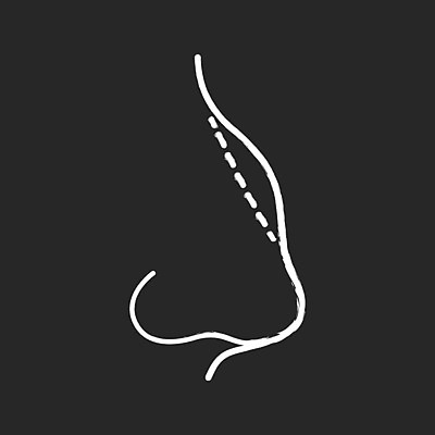 EPS 해외이미지 모양 직업 여자 얼굴 선 신체 일러스트 병원 뷰티 약 검은색 칠판 환자 흰색 그리기 수술 낙서 플라스틱 스케치 하락 피부 서비스 그림 분필 코 윤곽 손그림 외과 혹 순서 삭제 고립 돌봄 복원 해외일러스트 컬러 컨셉 의학 모션 재질 미술 사람 신체부위 초크 파일형식 벡터 이미지허브