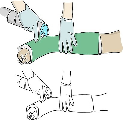 EPS 해외이미지 손 백그라운드 일러스트 뼈 건강 병원 사람 동양인 치료 파란색 약 기계 고통 장비 환자 간호사 의사 흰색 긴급 낙서 스케치 자르기 사건 그림 윤곽 손그림 팔 외과 삭제 고립 골절 깨짐 석고 양발 정형외과 커터 해외일러스트 감정 컬러 컨셉 의학 모션 미술 인종 신체부위 의료진 파일형식 벡터 이미지허브