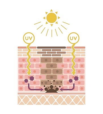 EPS 해외이미지 화살표 일러스트 의학 건강 사람없음 태양 질병 피부 자외선 피부트러블 피부층 해외일러스트 자연요소 신체부위 피부질환 파일형식 벡터 이미지허브