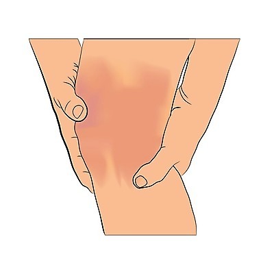EPS 해외이미지 스포츠 컨셉 일러스트 뼈 건강 치료 달리기 운동 고통 보호 유연 예방 양발 정형외과 플레이어 신청 해외일러스트 감정 의학 모션 병원 파일형식 벡터 이미지허브