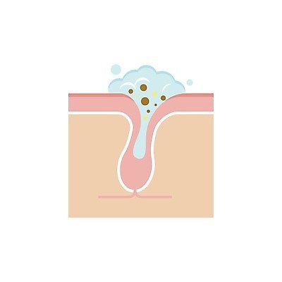 EPS 해외이미지 일러스트 의학 건강 사람없음 거품 씻기 피부 피부관리 스킨케어 모공 피부층 해외일러스트 신체부위 뷰티 청결 파일형식 벡터 이미지허브