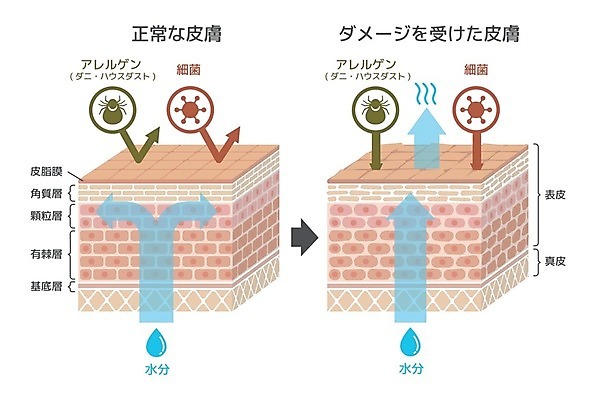 EPS 해외이미지 화살표 일러스트 의학 건강 사람없음 비교 바이러스 질병 수분 일본어 피부 피부관리 기생충 진드기 피부층 해외일러스트 문자 컨셉 신체부위 뷰티 해충 파일형식 벡터 이미지허브