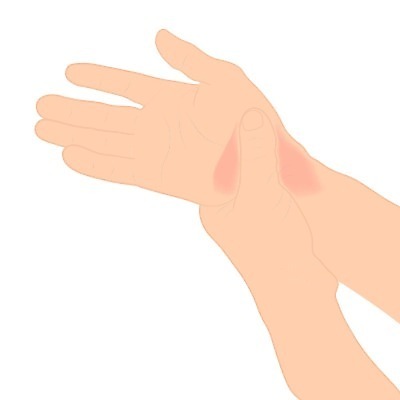 EPS 해외이미지 백인 손 컨셉 신체 일러스트 뼈 건강 병원 미술 사람 성인 빨간색 약 손상 손목 주사약 팔 고립 돌봄 제어 해외일러스트 서양인 컬러 의학 모션 문화예술 신체부위 파일형식 벡터 이미지허브