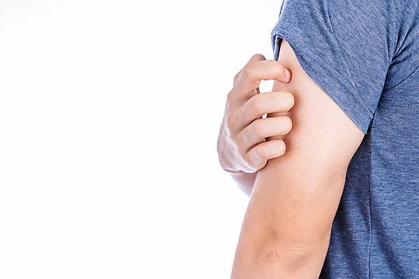 포토 JPG 해외이미지 표면 건조 건강 사람없음 치료 환자 짜증 거친 균열 질병 상처 피부 땀 감염 육군 문제 알레르기 깨짐 돌봄 명패 양발 염증 증상 해외포토 감정 컨셉 의학 모션 군대 신체부위 파일형식 이미지허브