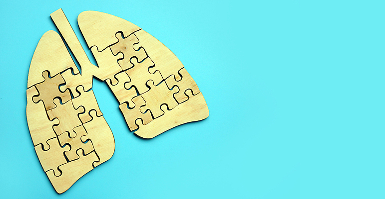 포토 JPG 해외이미지 라이프스타일 조각 컨셉 추상 건강 사람없음 치료 약 수술 오르간 호흡기관 질병 감염 문제 암 종양 천식 해외포토 무늬 의학 생활 장기_의학 건반악기 파일형식 이미지허브