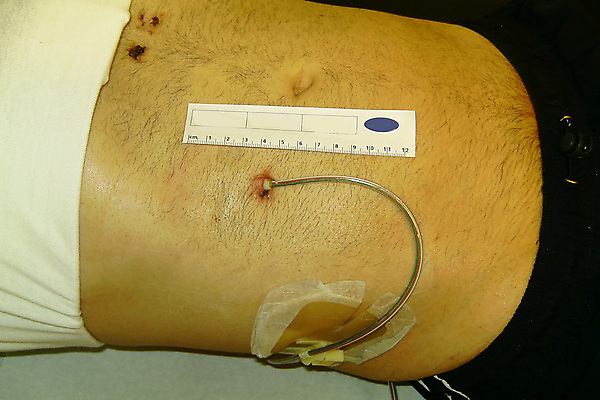 포토 JPG 해외이미지 비즈니스 사람없음 약 질병 상처 청소 피부 감염 분무기 점검 마우스피스 석고 소독 심장병 해외포토 의학 신체부위 파일형식 이미지허브