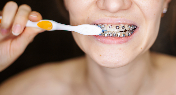 포토 JPG 해외이미지 백인 여자 실내 한명 미소 성인 일상 뷰티 치아 칫솔 치약 위생관리 치아건강 치아교정 성인여자한명만 해외포토 서양인 1 표정 건강 관리 사람 내부 라이프 위생용품 소화기관 교정 여자한명만 성인여자만 파일형식 이미지허브