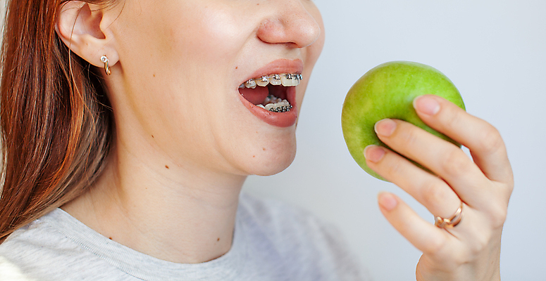 포토 JPG 해외이미지 여자 치과 한명 미소 성인 치아 사과 교정기 위생관리 치아건강 치아교정 성인여자한명만 해외포토 1 과일 표정 건강 병원 관리 사람 소화기관 교정 여자한명만 성인여자만 파일형식 이미지허브