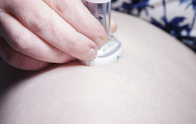 포토 JPG 해외이미지 손 여자 백그라운드 컨셉 손가락 추상 건강 관리 주사기 사람 사람없음 치료 가로 약 고통 환자 대접 막대기 질병 플라스틱 약국 피부 슛 처방 주사약 돌봄 복용 해외포토 감정 무늬 의학 의료기기 모션 재질 신체부위 파일형식 이미지허브