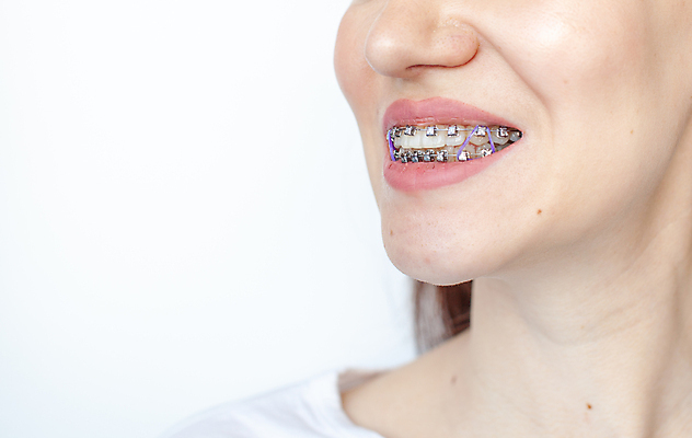 포토 JPG 해외이미지 여자 치과 한명 미소 성인 치아 교정기 위생관리 치아건강 치아교정 성인여자한명만 해외포토 1 표정 건강 병원 관리 사람 소화기관 교정 여자한명만 성인여자만 파일형식 이미지허브