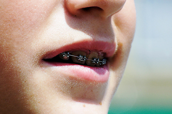 포토 JPG 해외이미지 어린이 신체 건강 치과 사람 사람없음 10대 청춘 건강관리 입 치아 복지 치과의사 턱 토막 규정 치통 해외포토 컨셉 청소년 병원 관리 신체부위 의사 소화기관 질병 사회이슈 파일형식 이미지허브