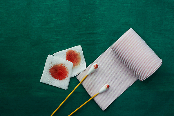 포토 JPG 해외이미지 비즈니스 청진기 미래 건강 병원 사람없음 치료 글로벌 약 건강관리 진료 고통 장비 환자 의사 덮개 공구 긴급 면 도움 네트워크 수술 보호 상처 구급차 사건 서비스 붕대 롤 외과 고립 돌봄 압축 지원 치유 살균 해외포토 감정 컨셉 의학 의료기기 모션 자동차 관리 의료진 뚜껑 도구 파일형식 이미지허브