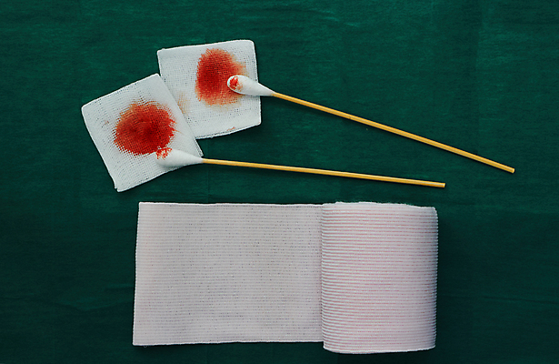 포토 JPG 해외이미지 비즈니스 청진기 미래 건강 병원 사람없음 치료 글로벌 약 건강관리 진료 고통 장비 환자 의사 덮개 공구 긴급 면 도움 네트워크 수술 보호 상처 구급차 사건 서비스 붕대 롤 외과 고립 돌봄 압축 지원 치유 살균 해외포토 감정 컨셉 의학 의료기기 모션 자동차 관리 의료진 뚜껑 도구 파일형식 이미지허브