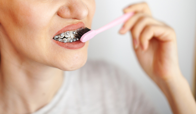 포토 JPG 해외이미지 여자 치과 한명 미소 성인 치아 칫솔 교정기 위생관리 치아건강 치아교정 성인여자한명만 해외포토 1 표정 건강 병원 관리 사람 위생용품 소화기관 교정 여자한명만 성인여자만 파일형식 이미지허브