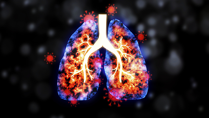 포토 JPG 해외이미지 과학 백그라운드 해부 건강 사람 사람없음 약 중국 오르간 허파 바이러스 질병 생물학 감염 암 인플루엔자 전염병 해외포토 교육 아시아 의학 건반악기 호흡기관 파일형식 이미지허브