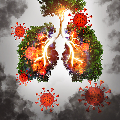 포토 JPG 해외이미지 나무 과학 일러스트 건강 사람 사람없음 초록색 약 환경 중국 고통 호흡기관 바이러스 질병 사인 감염 미생물 백신 전염병 사스 해외일러스트 식물 감정 아시아 컬러 의학 생물 장기_의학 파일형식 이미지허브