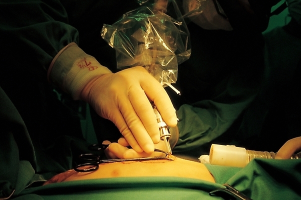 포토 JPG 주간 손 신체 의학 병원 사람 근접촬영 야외 신체부위 치료 의사 수술 외과의사 국내포토 자연요소 뷰포인트 의료진 파일형식