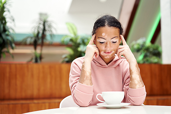 포토 JPG 해외이미지 여자 얼굴 분홍색 생각 손가락 탁자 실내 한명 앉기 인종 치료 머리 검은색 꿈 점 자신감 질병 승낙 피부 문제 내추럴 해외포토 1 손 감정 컬러 가구 컨셉 의학 모션 사람 내부 신체부위 파일형식 이미지허브
