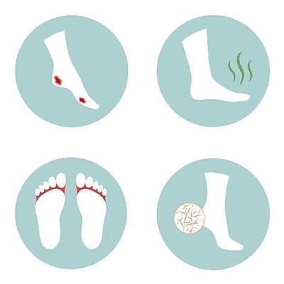 EPS 해외이미지 여자 일러스트 발 건조 사람 고통 균열 지저분함 질병 상처 피부 냄새 감염 문제 발가락 악취 고립 곰팡이 당뇨병 돌봄 양발 해외일러스트 감정 의학 모션 신체부위 감각 파일형식 벡터 이미지허브