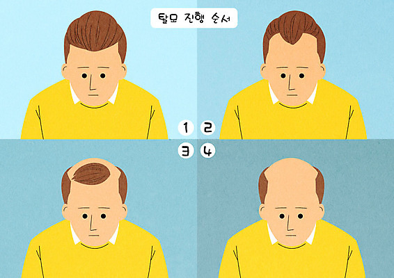 PSD 남자 일러스트 여러명 성인 머리카락 슬픔 좌절 대머리 빠짐 순서 진행 증상 탈모 탈모클리닉 국내일러스트 헤어스타일 감정 다수 컨셉 사람 머리 클리닉 파일형식