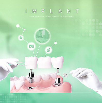 PSD 편집이미지 손 건강 치과 신체부위 초록색 치아 치과의사 치아모형 치과진료 임플란트 잇몸 치아건강 이미지편집 컬러 신체 병원 사람 진료 의사 소화기관 파일형식
