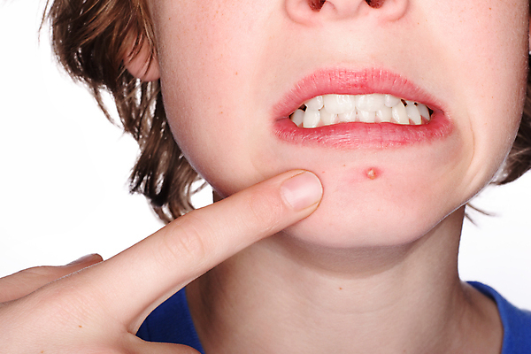 포토 JPG 해외이미지 백인 남자 얼굴 어린이 손가락 청소년 건강 한명 소년 10대 빨간색 청춘 뷰티 머리 성장 짜증 가리킴 점 찡그림 치아 폭발 손톱 피부 피부관리 감염 여드름 개발 끓이기 사춘기 위생관리 못생김 호르몬 해외포토 서양인 1 손 감정 컬러 컨셉 모션 표정 관리 사람 손짓 신체부위 소화기관 파일형식 이미지허브