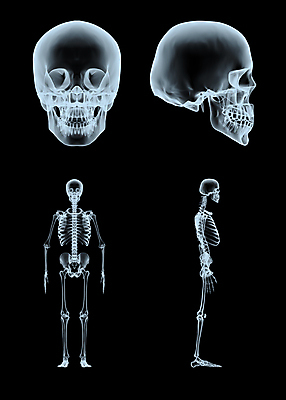 포토 JPG 해외이미지 척추동물 신체 일러스트 해부 뼈 골격 엑스레이 사람 사람없음 그래픽 3D 환자 흉부 생물학 만들기 방사선 해골모형 해외일러스트 동물 교육 의학 모션 모형 호흡기관 디지털합성 파일형식 이미지허브