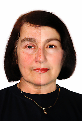 포토 JPG 해외이미지 백인 모델 편집 1 여자 얼굴 한명 사람 성인 뷰티 유행 화장품 활발 흰색 주름 매끈함 플라스틱 피부 피부관리 지우개 리프트 반대 외과 삭제 고립 돌봄 리프팅 전후 노화 해외포토 서양인 컬러 컨셉 의학 모션 재질 학용품 병원 신체부위 감각 비교 파일형식 이미지허브