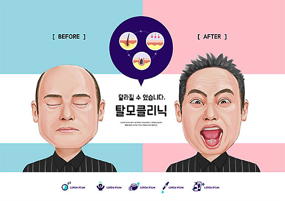 PSD 편집이미지 남자 분홍색 웃음 사람 성인 두명 파란색 머리카락 희망 기쁨 비교 울음 대머리 탈모 탈모클리닉 성인남자만 모낭 이미지편집 헤어스타일 감정 컬러 컨셉 표정 머리 클리닉 증상 남자만 성인만 파일형식