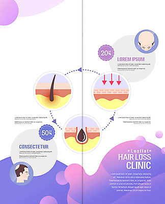 PSD 템플릿 표지디자인 북디자인 출판디자인 남자 내지 2단접지 북커버 팜플렛 성인 두명 머리카락 보라색 두피 두피관리 모발이식 탈모 탈모클리닉 성인남자만 모낭 이미지템플릿 리플렛 컬러 사람 머리 클리닉 증상 남자만 성인만 파일형식