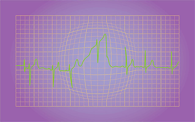 EPS 해외이미지 스포츠 파도 일러스트 그래프 건강 병원 실험 사람 그래픽 독서 약 디지털 모니터 기구 공구 하트 오르간 맥박 분석 측정 속도 전자 반항 돌봄 심장병 심전도 해외일러스트 모양 바다 컨셉 의학 모션 컴퓨터 도구 건반악기 질병 파일형식 벡터 이미지허브