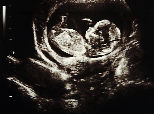 포토 JPG 해외이미지 여자 어린이 과학 엄마 사람 사람없음 약 소리 임신 아기 일주일 4 태교 태아 자궁 월 돌봄 해외포토 의학 가족 모션 숫자 장기_의학 날짜 파일형식 이미지허브