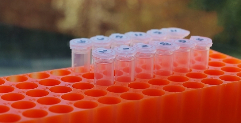 포토 JPG 해외이미지 직업 학생 교육 과학 백그라운드 오렌지 유리 건강 병원 실험 안전 사람 사람없음 파란색 스터디 숫자 약 장비 의사 흰색 업무 액체 기술자 실험실 생명공학 위험 약국 플라스크 분석 생물학 미생물 튜브 박테리아 발견 조제 고립 돌봄 신발장 화학물질 화학자 해외포토 문자 컬러 컨셉 과일 의학 모션 재질 생물 실험기구 학습 의료진 작업 화학 과학자 만들기 파일형식 이미지허브