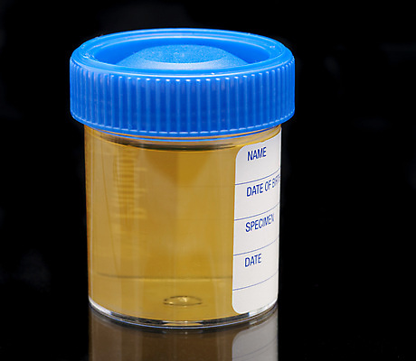 포토 JPG 해외이미지 실험 사람없음 노란색 견본 검은색 시험 항아리 액체 실험실 해외포토 교육 컬러 도자기 파일형식 이미지허브