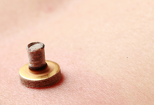 포토 JPG 해외이미지 사람없음 오브젝트 테라피 연소 쑥뜸 해외포토 뷰티 파일형식 이미지허브