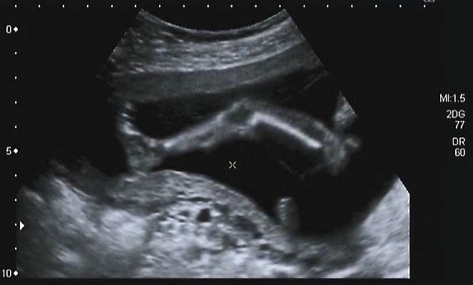 포토 JPG 해외이미지 백인 직업 손 장갑 손가락 상상 건강 병원 사람없음 내부 치료 스터디 약 기계 방 장비 환자 의사 탐험 긴급 업무 결과 질병 외과 돌봄 스캔 제어 헬프 해외포토 서양인 잡화 컨셉 의학 모션 신체부위 학습 의료진 작업 도움 파일형식 이미지허브