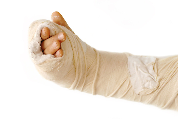 포토 JPG 해외이미지 1 손 어린이 신체 포장 뼈 건강 사람없음 치료 10대 고통 환자 흰색 잡기 시간 도움 상처 장애인 묶기 사건 붕대 팔 보험 빈털터리 고립 골절 깨짐 석고 정형외과 치유 해외포토 감정 컬러 컨셉 의학 모션 청소년 병원 사람 신체부위 장애 파일형식 이미지허브