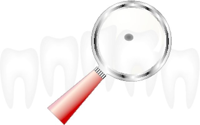 EPS 해외이미지 응시 컨셉 일러스트 유리 건강 치과 시험 탐험 흰색 구멍 투명 확대 치아 질병 연습 검색 치과의사 발견 돌봄 썩음 탐지 해외일러스트 시선 교육 컬러 의학 모션 재질 병원 의사 소화기관 파일형식 벡터 이미지허브