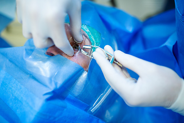 포토 JPG 서양인 외국인 손 여자 남자 실내 병원 사람 앉기 성인 두명 신체부위 눕기 머리 환자 수술 수술복 체코 수술실 안과 수술기구 안과의사 안구 성인만 국내포토 유럽 의학 의료기기 모션 인종 내부 치료 의사 가운 파일형식