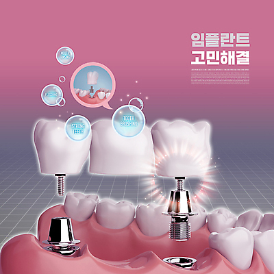 PSD 편집이미지 분홍색 말풍선 치과 타이포그라피 사람없음 빛 치아 치아모형 나사못 임플란트 잇몸 치아건강 이미지편집 문자 컬러 신체 건강 병원 못 소화기관 파일형식