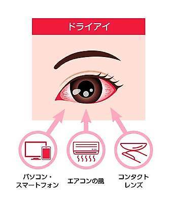 EPS 해외이미지 일러스트 의학 바람 건조 건강 사람없음 스마트폰 모니터 질병 에어컨 충혈 콘택트렌즈 안구건조증 해외일러스트 자연요소 날씨 핸드폰 스마트기기 컴퓨터 가전제품 파일형식 벡터 이미지허브