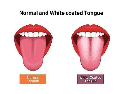 EPS 해외이미지 일러스트 의학 건강 사람없음 치아 질병 구강 혀 입술 백태 치아건강 구강검진 해외일러스트 신체부위 검진 입 소화기관 파일형식 벡터 이미지허브