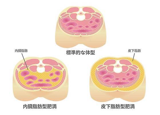 EPS 해외이미지 일러스트 의학 건강 사람없음 질병 단면도 복부비만 체지방 내장지방 해외일러스트 단면 지방_기름 비만 파일형식 벡터 이미지허브