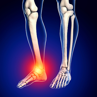 포토 JPG 해외이미지 남자 백그라운드 신체 일러스트 해부 뼈 골격 엑스레이 건강 사람 사람없음 파란색 3D 고통 시험 광선 X 생물학 골다공증 시스템 발가락 발목 고립 양발 정형외과 해외포토 알파벳 교육 감정 컬러 의학 발 병원 질병 디지털합성 파일형식 이미지허브