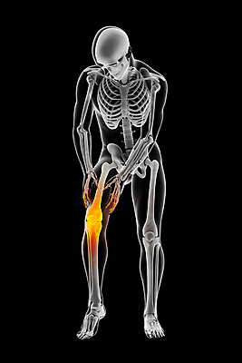 포토 JPG 해외이미지 남자 스포츠 과학 신체 일러스트 해부 뼈 골격 건강 사람 사람없음 그래픽 운동 약 3D 고통 의사 마사지 질병 상처 사건 관절염 근육질 무릎 외과 테라피 달리기선수 부담 염증 치유 해외포토 감정 의학 근육 병원 신체부위 뷰티 의료진 몸매 디지털합성 육상선수 파일형식 이미지허브