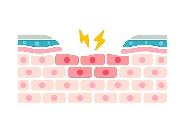 EPS 해외이미지 일러스트 의학 건강 사람없음 질병 각막 안구건조증 피부층 해외일러스트 눈_신체부위 피부 파일형식 벡터 이미지허브