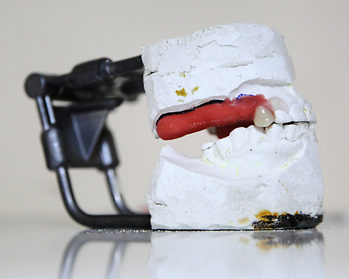 포토 JPG 해외이미지 왕관 새로움 건강 치과 사람 사람없음 치료 약 화장품 환자 도구 도자기 입 황금 실험실 치아 질병 파편 고정 턱 틀니 거짓 고립 곰팡이 돌봄 백자 보철 삽입 옛날 인공 해외포토 컨셉 의학 모션 병원 실험 신체부위 뷰티 소화기관 파일형식 이미지허브